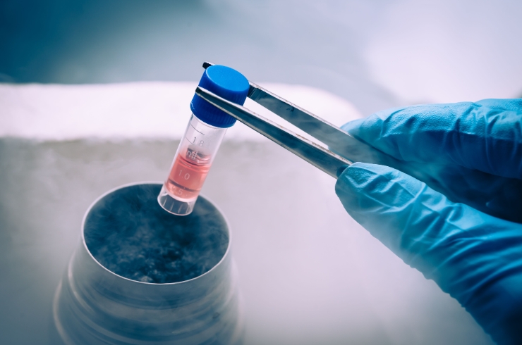 Frozen Embryo Transfer (FET)-----33