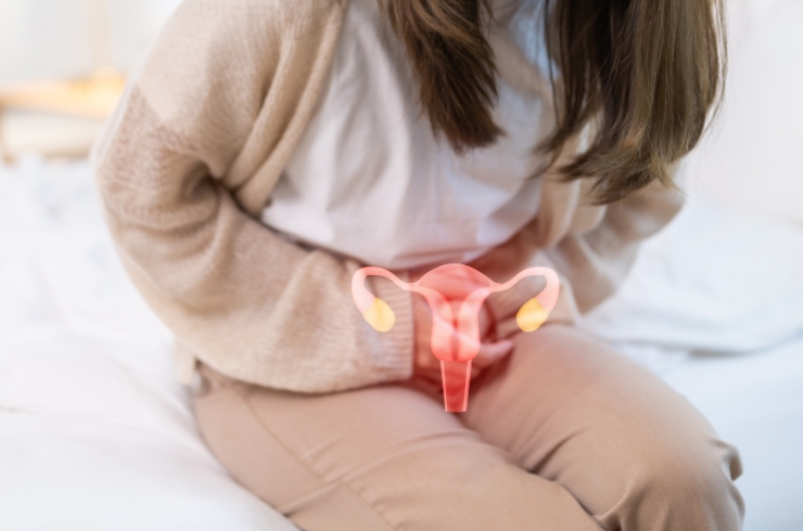 IUI (Intrauterine Insemination) ----33