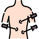 Laparoscopic Myomectomy & Cystectomy